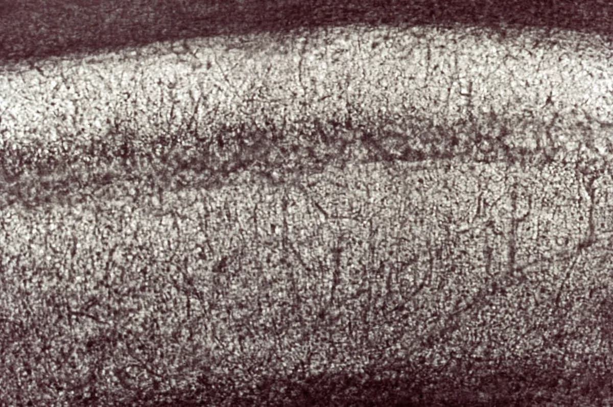Imagem de microscopia em tons de cinza e marrom mostrando uma faixa de tecido com centenas de pequenos pontos escuros e filamentos finos.