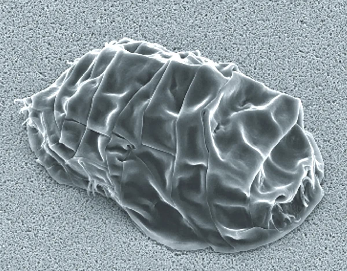 Imagem em preto e branco de microscópio eletrônico mostrando um corpo oval, compacto e coberto de dobras profundas, sem patas visíveis.